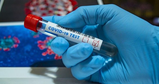 أخبار ألمانيا: اختبارات مجانية للجميع للكشف عن الإصابة بفيروس كورونا