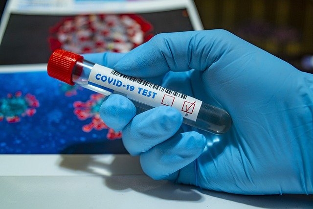 أخبار ألمانيا: اختبارات مجانية للجميع للكشف عن الإصابة بفيروس كورونا