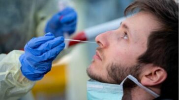 تكلفة اختبار كورونا في ألمانيا